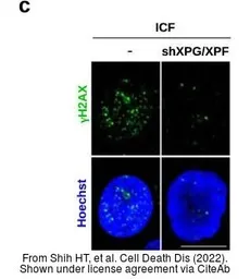 Anti-Histone H2A.XS139ph (phospho Ser139) antibody used in Immunocytochemistry/ Immunofluorescence (ICC/IF). GTX127340