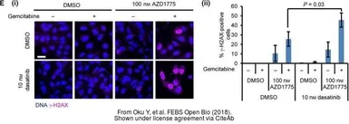 Anti-Histone H2A.XS139ph (phospho Ser139) antibody used in Immunocytochemistry/ Immunofluorescence (ICC/IF). GTX127340