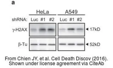 Anti-Histone H2A.XS139ph (phospho Ser139) antibody used in Western Blot (WB). GTX127340
