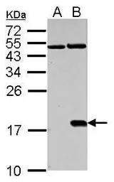 Anti-Histone H2A.XS139ph (phospho Ser139) antibody used in Western Blot (WB). GTX127340