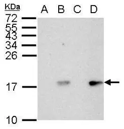 Anti-Histone H2A.XS139ph (phospho Ser139) antibody used in Western Blot (WB). GTX127340