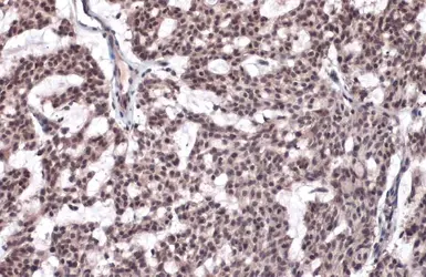 Anti-Histone H2A.XS139ph (phospho Ser139) antibody used in IHC (Paraffin sections) (IHC-P). GTX127340