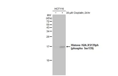Anti-Histone H2A.XS139ph (phospho Ser139) antibody used in Western Blot (WB). GTX127340
