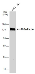 Anti-N-Cadherin antibody used in Western Blot (WB). GTX127345