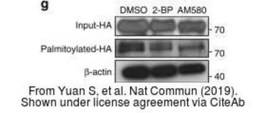 Anti-Influenza A virus H1N1 HA (Hemagglutinin) antibody used in Western Blot (WB). GTX127357