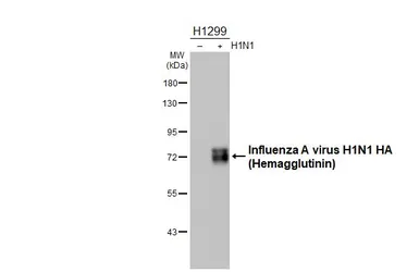 Anti-Influenza A virus H1N1 HA (Hemagglutinin) antibody used in Western Blot (WB). GTX127357