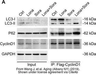 Anti-LC3B antibody used in Western Blot (WB). GTX127375
