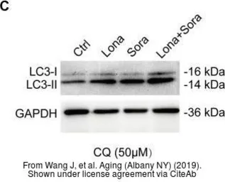 Anti-LC3B antibody used in Western Blot (WB). GTX127375