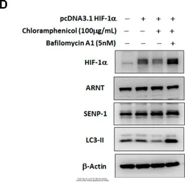 Anti-LC3B antibody used in Western Blot (WB). GTX127375