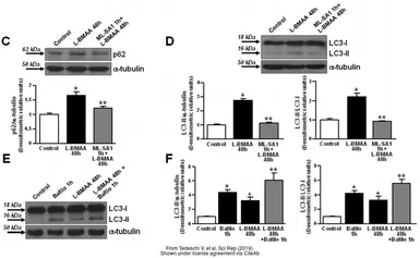 Anti-LC3B antibody used in Western Blot (WB). GTX127375