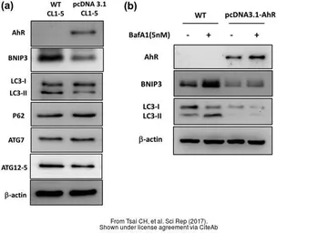 Anti-LC3B antibody used in Western Blot (WB). GTX127375