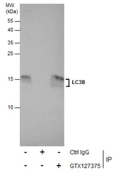 Anti-LC3B antibody used in Immunoprecipitation (IP). GTX127375
