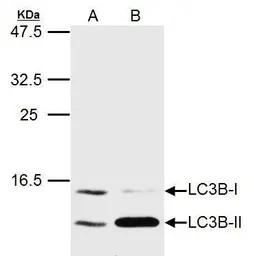 Anti-LC3B antibody used in Western Blot (WB). GTX127375