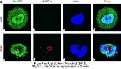 Anti-Dengue virus prM protein antibody used in Immunocytochemistry/ Immunofluorescence (ICC/IF). GTX128092