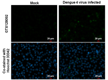 Anti-Dengue virus prM protein antibody used in Immunocytochemistry/ Immunofluorescence (ICC/IF). GTX128092