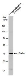 Anti-Pax2a antibody used in Western Blot (WB). GTX128127