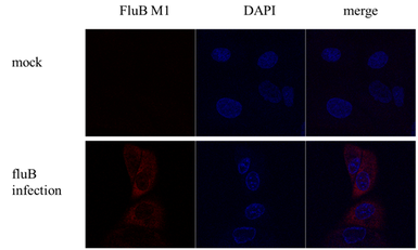 Anti-Influenza B virus M (matrix protein) antibody used in Immunocytochemistry/ Immunofluorescence (ICC/IF). GTX128537