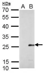 Anti-Influenza B virus M (matrix protein) antibody used in Western Blot (WB). GTX128537