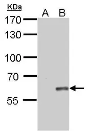 Anti-Influenza B virus Nucleoprotein antibody used in Western Blot (WB). GTX128539