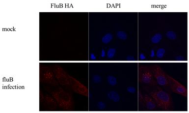 Anti-Influenza B virus Hemagglutinin (HA) antibody used in Immunocytochemistry/ Immunofluorescence (ICC/IF). GTX128542