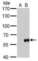 Anti-Influenza B virus Hemagglutinin (HA) antibody used in Western Blot (WB). GTX128542