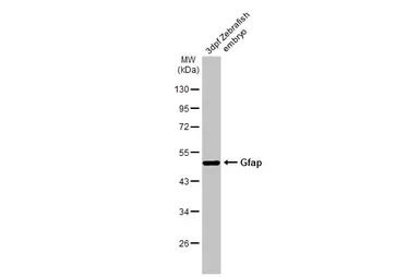 Anti-Gfap antibody used in Western Blot (WB). GTX128741