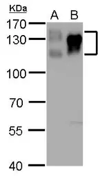 Anti-Integrin beta 1 / CD29 antibody used in Western Blot (WB). GTX128839