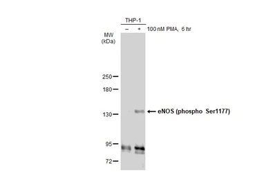 Anti-eNOS (phospho Ser1177) antibody used in Western Blot (WB). GTX129058
