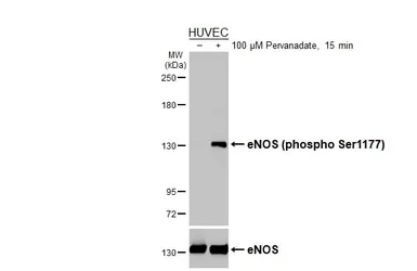 Anti-eNOS (phospho Ser1177) antibody used in Western Blot (WB). GTX129058