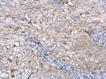 Anti-AXL antibody used in IHC (Paraffin sections) (IHC-P). GTX129407