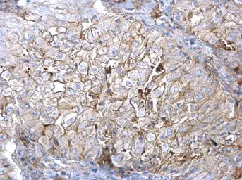 Anti-AXL antibody used in IHC (Paraffin sections) (IHC-P). GTX129407