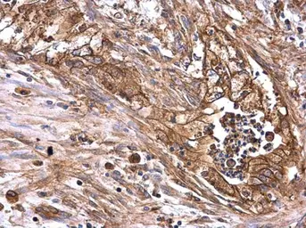 Anti-AXL antibody used in IHC (Paraffin sections) (IHC-P). GTX129407