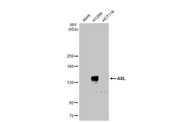 Anti-AXL antibody used in Western Blot (WB). GTX129407