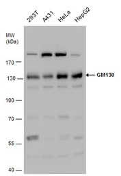 Anti-GM130 antibody used in Western Blot (WB). GTX130351