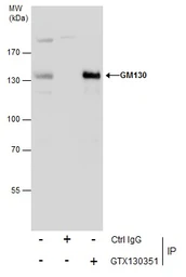 Anti-GM130 antibody used in Immunoprecipitation (IP). GTX130351