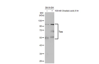 Anti-Tau antibody used in Western Blot (WB). GTX130462