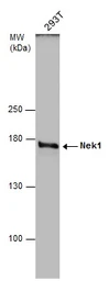Anti-Nek1 antibody used in Western Blot (WB). GTX130828