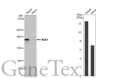 Anti-Nek1 antibody used in Western Blot (WB). GTX130828