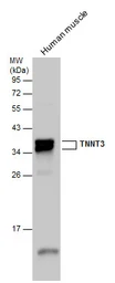 Anti-Troponin T fast skeletal antibody used in Western Blot (WB). GTX130922