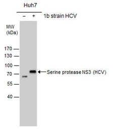 Anti-Hepatitis C virus NS3 protein antibody used in Western Blot (WB). GTX131269