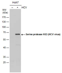 Anti-Hepatitis C virus NS3 protein antibody used in Western Blot (WB). GTX131269