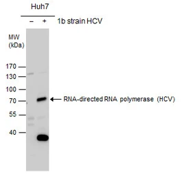 Anti-Hepatitis C virus NS5B protein antibody used in Western Blot (WB). GTX131273
