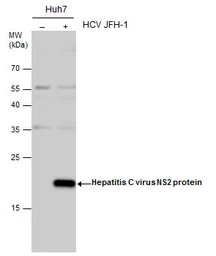 Anti-Hepatitis C virus NS2 protein antibody used in Western Blot (WB). GTX131832