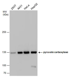 Anti-Pyruvate Carboxylase antibody used in Western Blot (WB). GTX132002