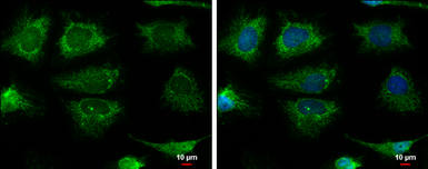 Anti-Pyruvate Carboxylase antibody used in Immunocytochemistry/ Immunofluorescence (ICC/IF). GTX132002