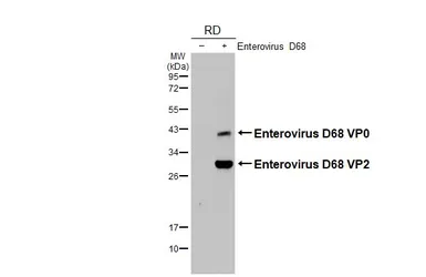 Anti-Enterovirus D68 VP2 antibody used in Western Blot (WB). GTX132314