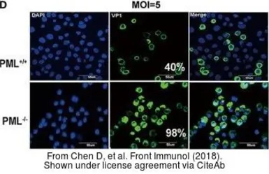 Anti-Enterovirus 71 VP1 antibody used in Immunocytochemistry/ Immunofluorescence (ICC/IF). GTX132338