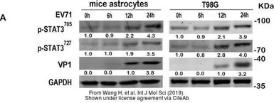 Anti-Enterovirus 71 VP1 antibody used in Western Blot (WB). GTX132338