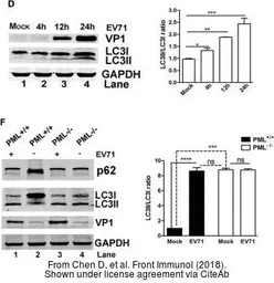 Anti-Enterovirus 71 VP1 antibody used in Western Blot (WB). GTX132338