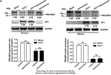 Anti-Enterovirus 71 VP1 antibody used in Western Blot (WB). GTX132338